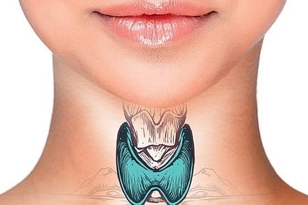 2 alimentos que você deve cortar da alimentação se você sofre com a Tireoide. 08 10 50 Mulher Tireoide 1